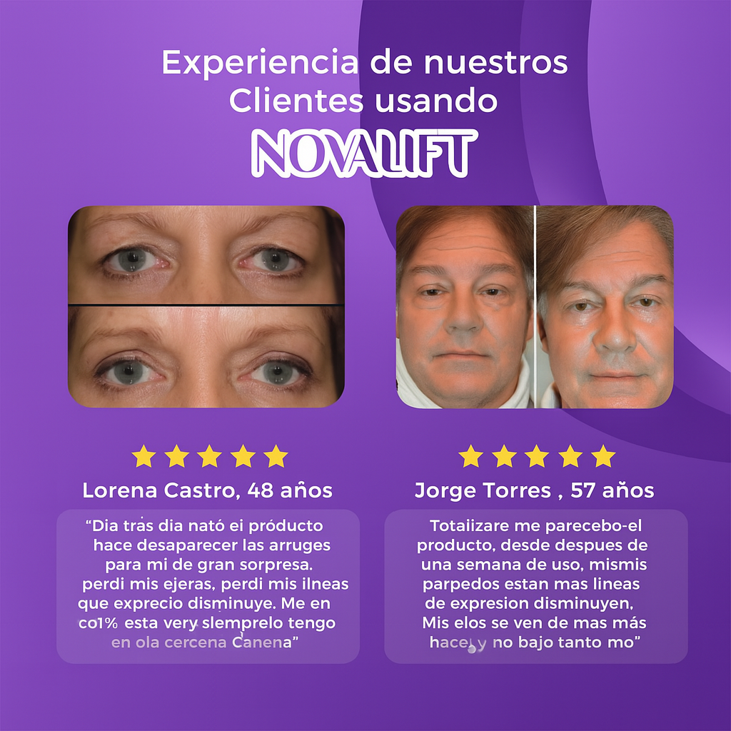 NovaLift© - Elimina ojeras y bolsas en solo 7 días